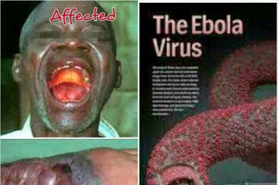 Dịch Ebola: Việt Nam định mua 10.000 bộ quần áo phòng hộ